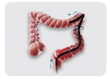 Video Endoscope System V2